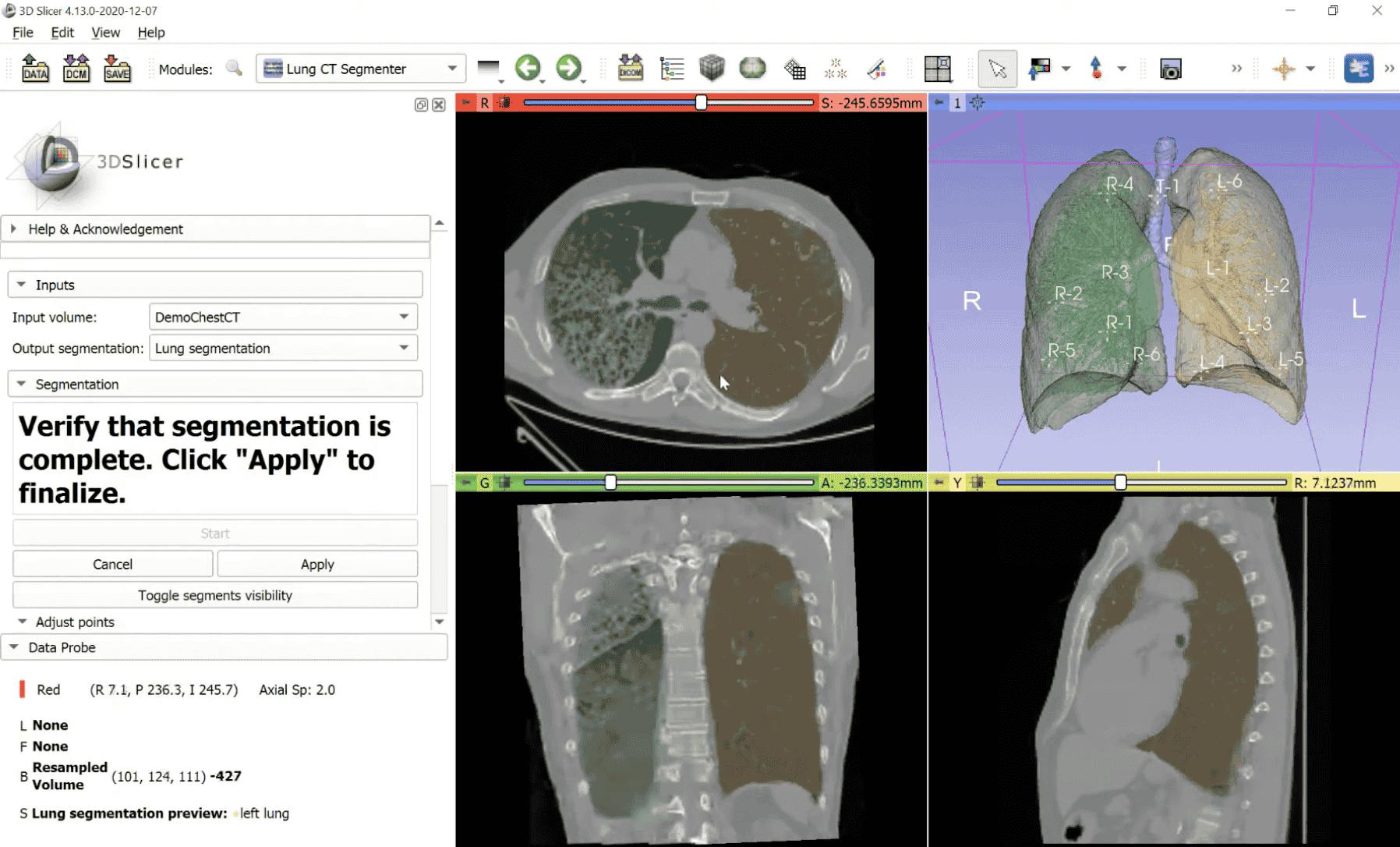 3D slicer DICOM annotator