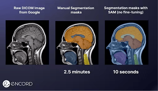 Auto-Segmentation with SAM Dataset